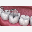 Braces, Dentist in Polokwane at HopeWell Med (55387)