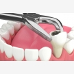Braces, Dentist in Polokwane at HopeWell Med (55392)