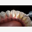 Braces, Dentist in Polokwane at HopeWell Med (55393)