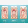 Teeth Whitening at Elite Dental Studios (63789)