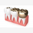 Teeth Whitening at Elite Dental Studios (63791)
