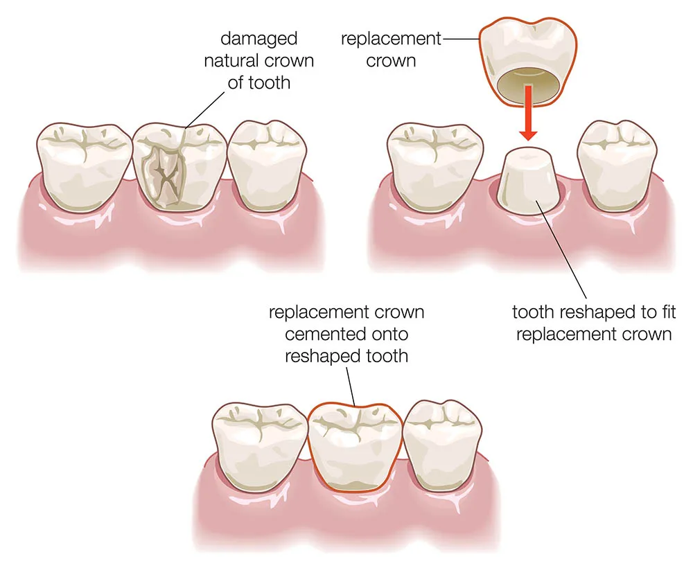 Braces, Dentist in Polokwane at HopeWell Med photo 1