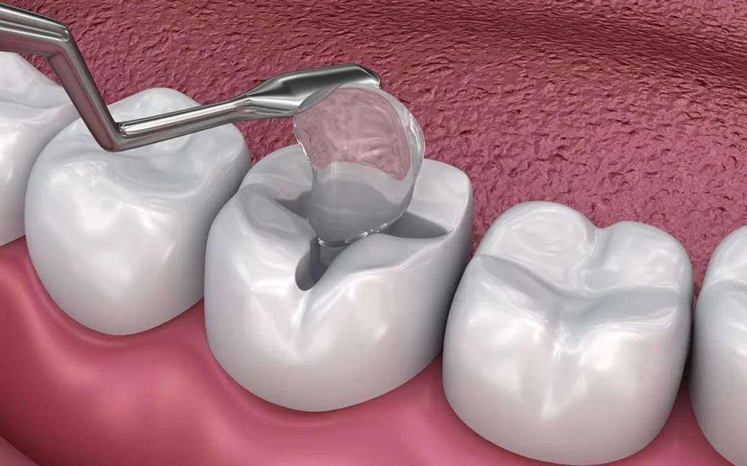 Braces, Dentist in Polokwane at HopeWell Med photo 2