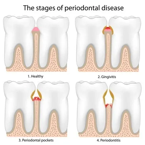 Braces, Dentist in Polokwane at HopeWell Med photo 3