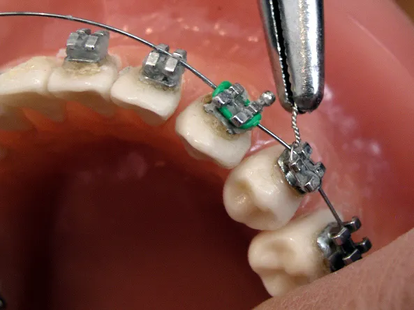 Polokwane Dentist - Dr M M Pula Inc photo 2
