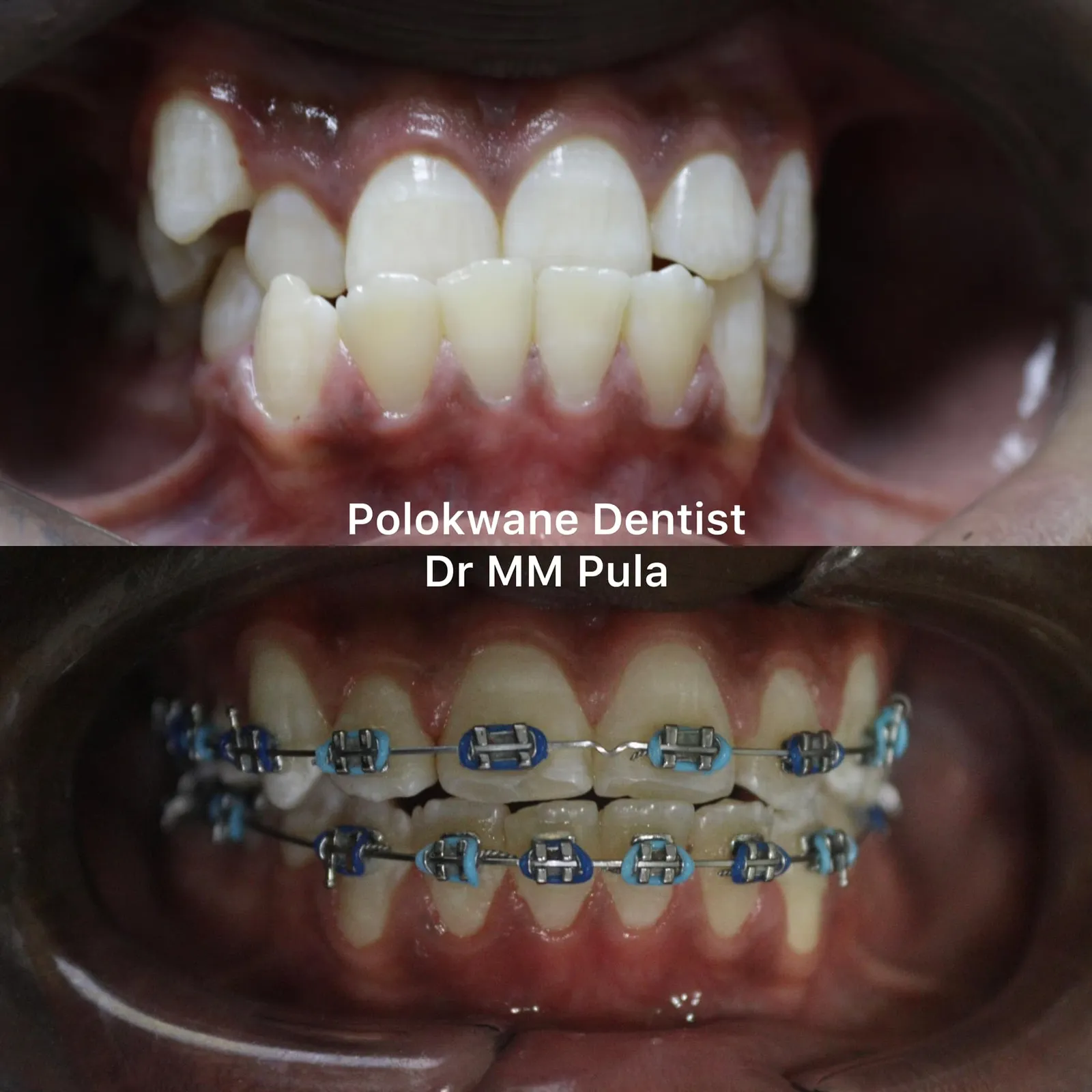 Polokwane Dentist - Dr M M Pula Inc photo 3