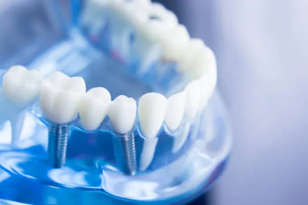 Aplus Dentistry photo 4