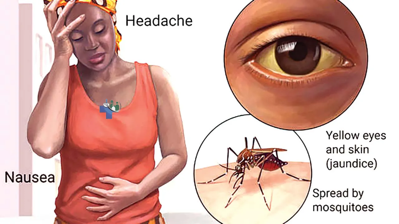 Men's Health, Yellow Fever at Palm Health Med photo 3