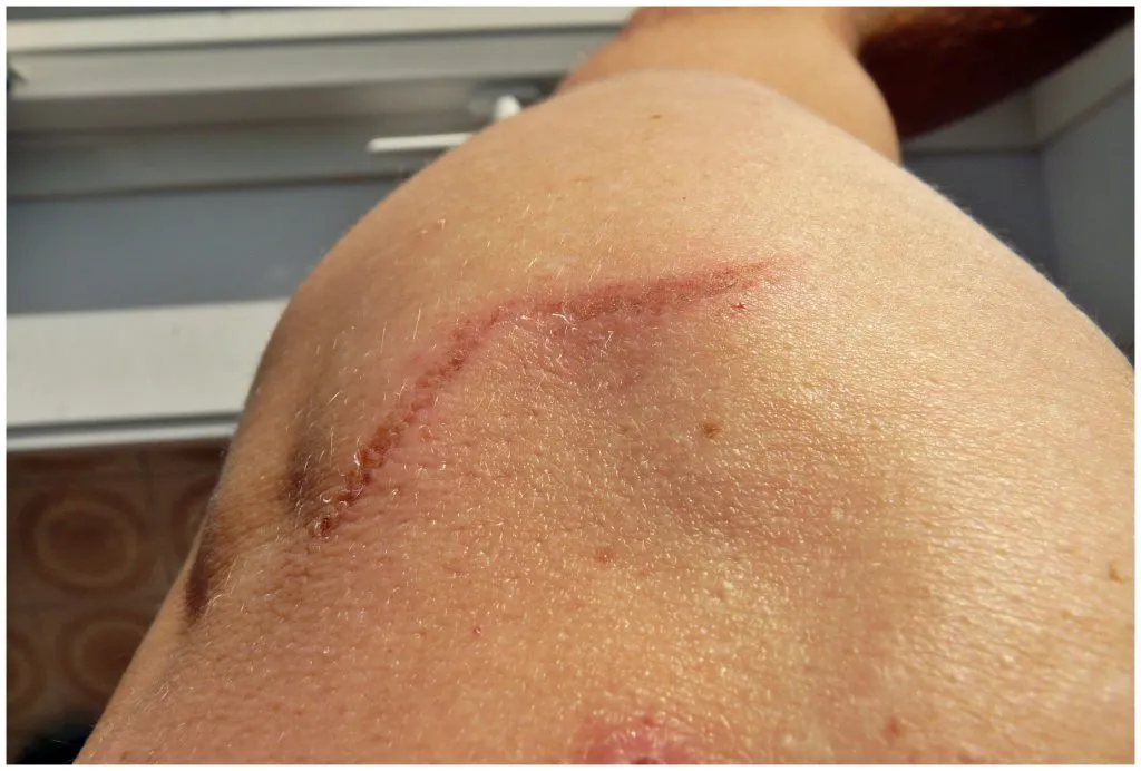 Mels Skin Clinic photo 2