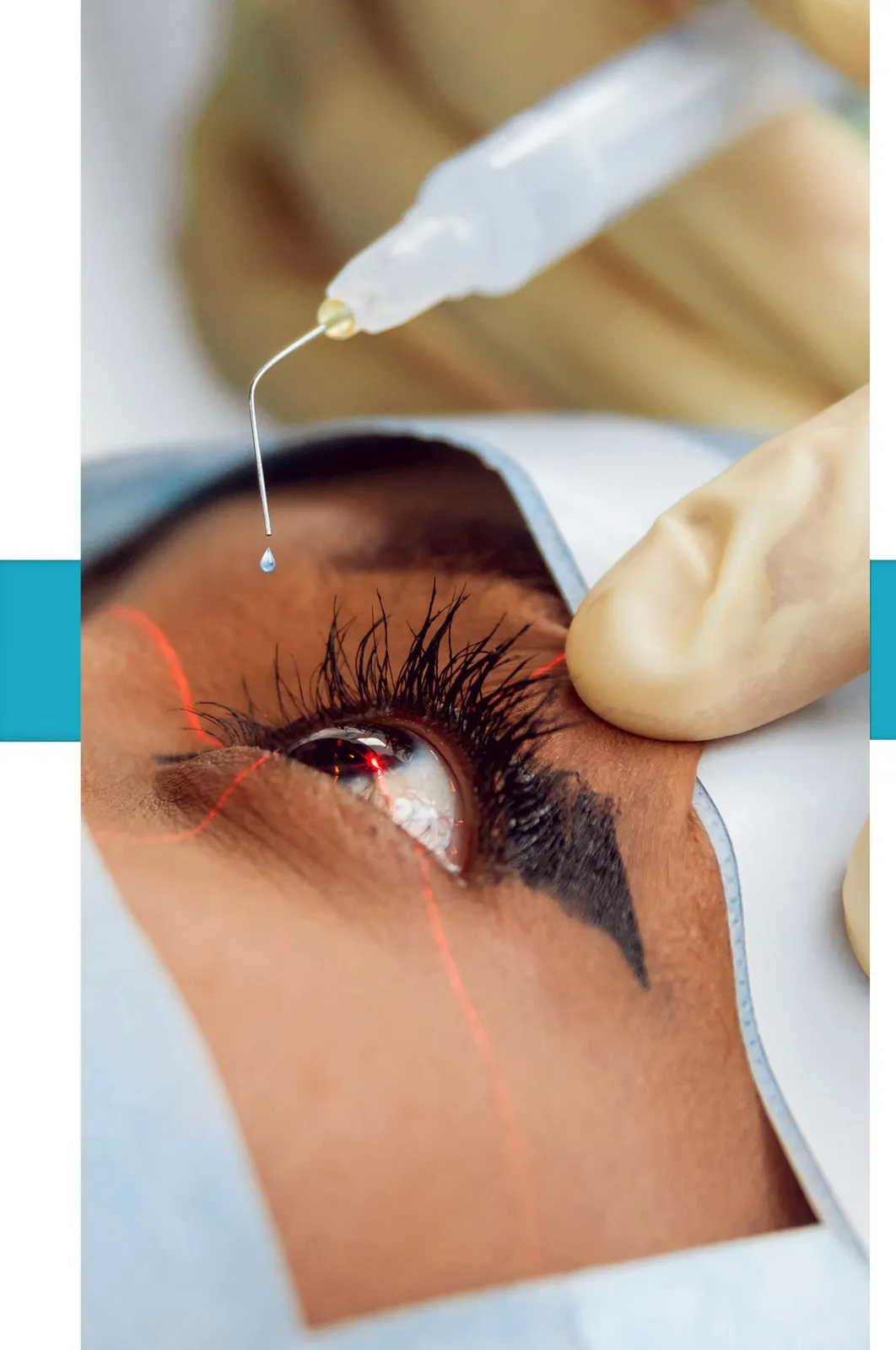 Dr. Sachin Bawa Cataract & Vision Clinic photo 3